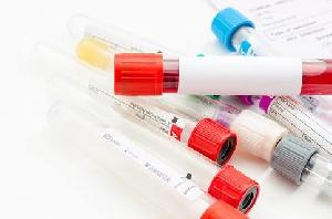 抗生素类检测在液相色谱串联质谱中的应用